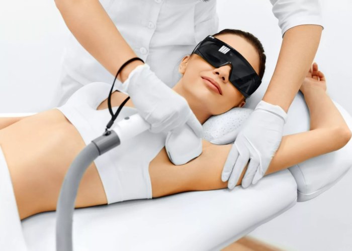 laser_epilation